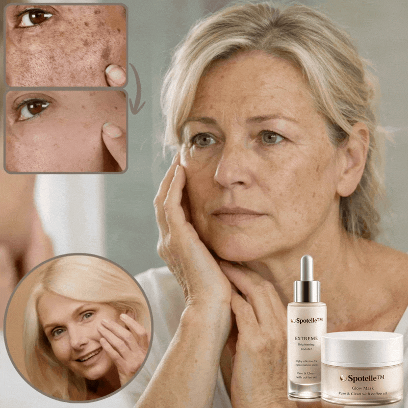 Spotelle™ Anti-pigmentvlekcrème | Helpt donkere vlekken zichtbaar te verminderen en zorgt voor een stralendere huid